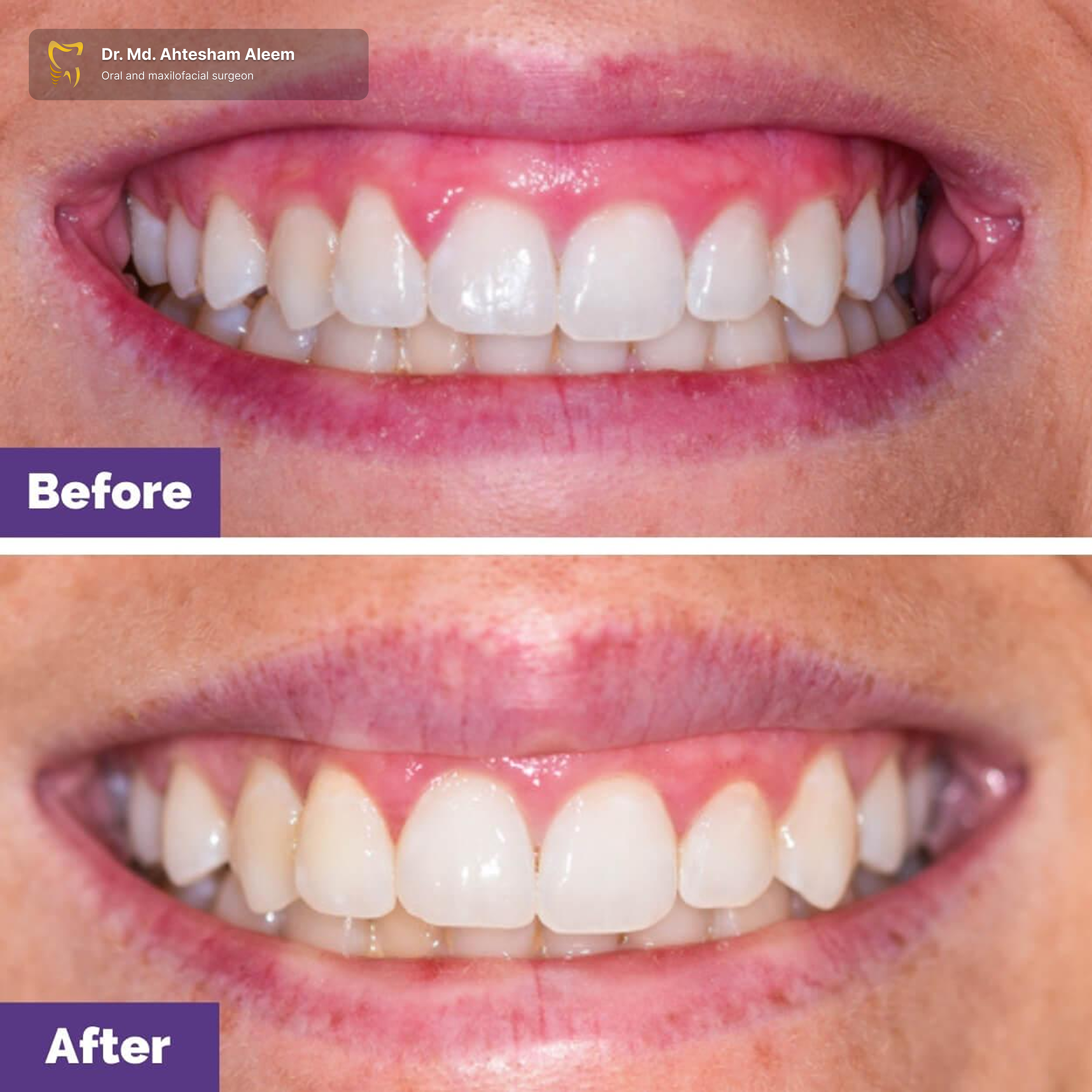 Advanced Laser Dentistry Gallery 1