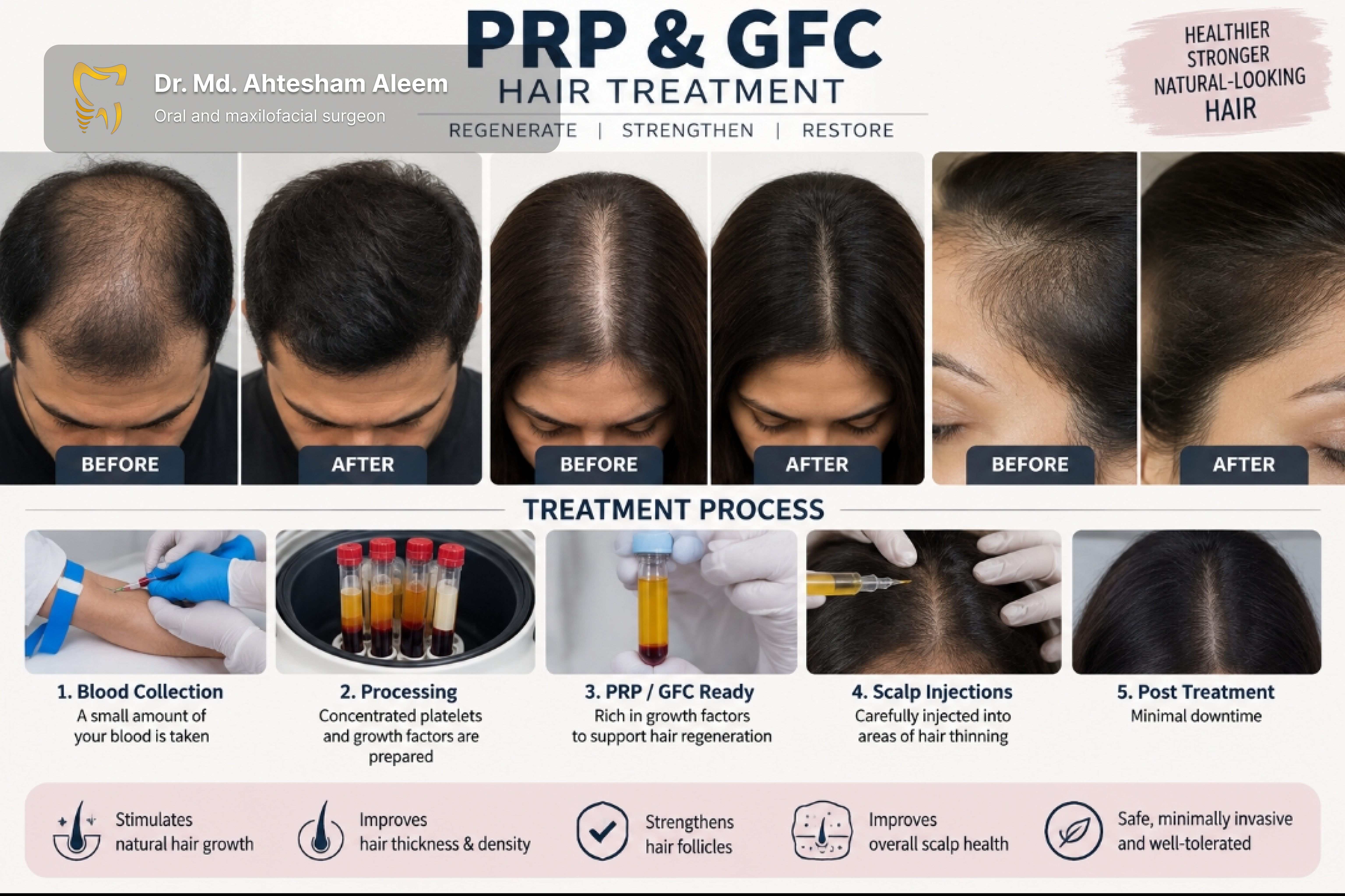PRP & GFC Hair Treatment Gallery 1
