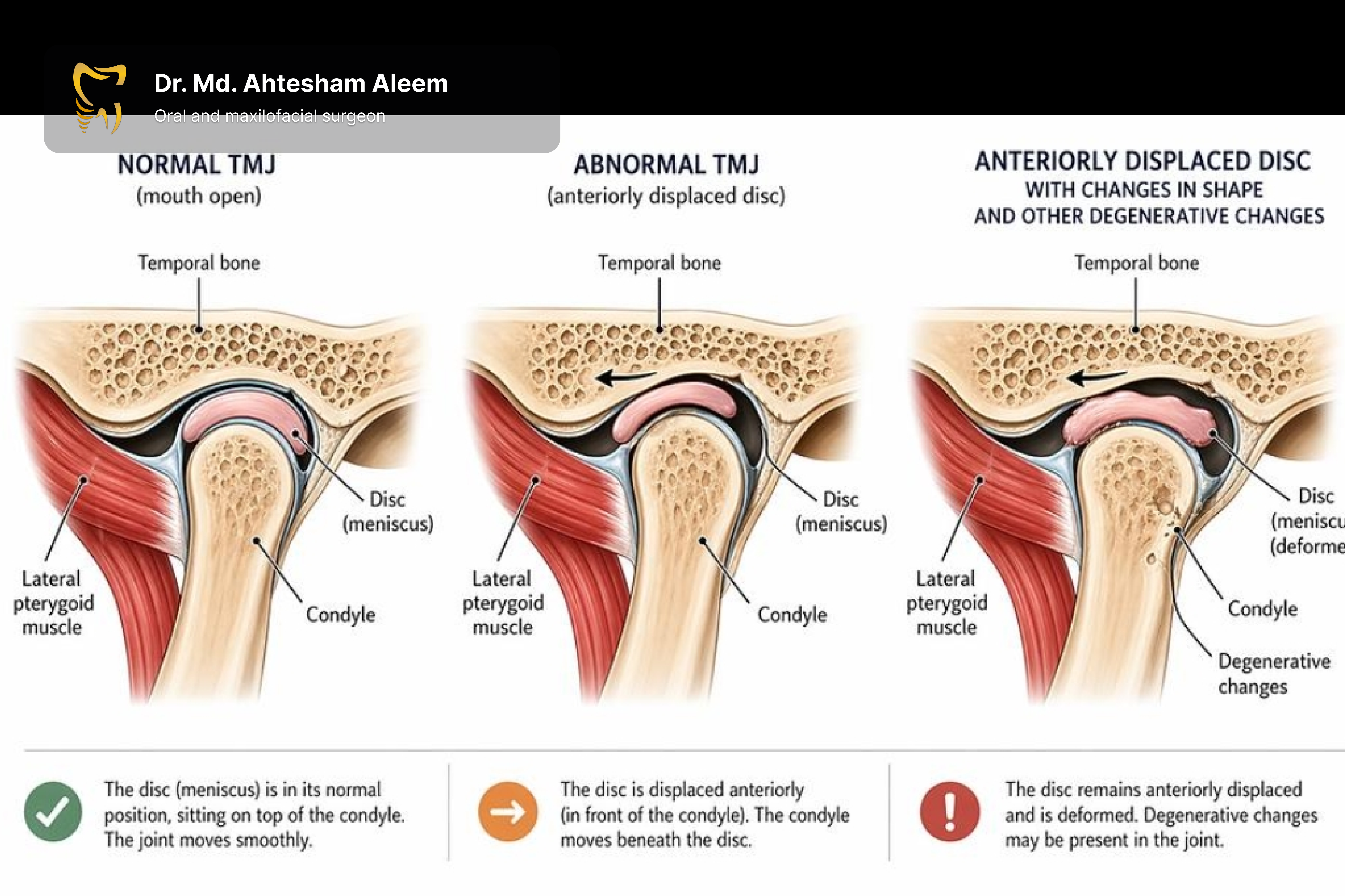 TMJ Dysfunction & Disorders Gallery 1